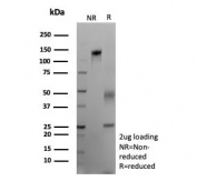 SDS-PAGE analysis of purified, BSA-free recombinant STMN1 antibody (clone rSTMN1/9255) as confirmation of integrity and purity.