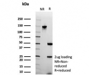 SDS-PAGE analysis of purified, BSA-free Stathmin 1 antibody (clone STMN1/8437) as confirmation of integrity and purity.