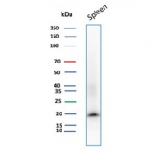 Western blot testing of human spleen tissue with Stathmin 1 antibody (clone STMN1/8437). Predicted molecular weight ~17 kDa.