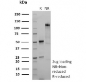 SDS-PAGE analysis of purified, BSA-free recombinant Stathmin 1 antibody (clone STMN1/9227R) as confirmation of integrity and purity.