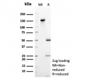 SDS-PAGE analysis of purified, BSA-free CD35 antibody (clone CD35/9444) as confirmation of integrity and purity.