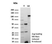 SDS-PAGE analysis of purified, BSA-free recombinant CK15 antibody (clone KRT15/9088R) as confirmation of integrity and purity.