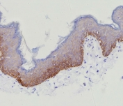 IHC staining of FFPE human skin tissue with recombinant CK15 antibody (clone KRT15/9088R). HIER: boil tissue sections in pH 9 10mM Tris with 1mM EDTA for 20 min and allow to cool before testing.