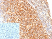 IHC staining of FFPE human tonsil tissue with recombinant CR2 antibody (clone rCR2/9537). Inset: PBS used in place of primary Ab (secondary Ab negative control). HIER: boil tissue sections in pH 9 10mM Tris with 1mM EDTA for 20 min and allow to cool before testing.