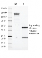 SDS-PAGE analysis of purified, BSA-free Transglutaminase 2 antibody (clone SPM358) as confirmation of integrity and purity.