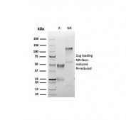 SDS-PAGE analysis of purified, BSA-free S100A1 antibody (clone S100A1/6374R) as confirmation of integrity and purity.