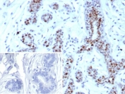 IHC staining of FFPE human breast tissue with recombinant GATA-binding factor 3 antibody (clone rGATA3/9133). Inset: PBS used in place of primary Ab (secondary Ab negative control). HIER: boil tissue sections in pH 9 10mM Tris with 1mM EDTA for 20 min and allow to cool before testing.