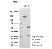 SDS-PAGE analysis of purified, BSA-free recombinant S100P antibody (clone rS100P/9254) as confirmation of integrity and purity.