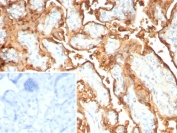 IHC staining of FFPE human placental tissue with recombinant S100P antibody (clone rS100P/9254). Inset: PBS used in place of primary Ab (secondary Ab negative control). HIER: boil tissue sections in pH 9 10mM Tris with 1mM EDTA for 20 min and allow to cool before testing.