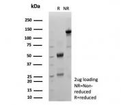 SDS-PAGE analysis of purified, BSA-free recombinant MIG9 antibody (clone S100P/9135R) as confirmation of integrity and purity.