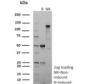 SDS-PAGE analysis of purified, BSA-free recombinant CD40 antibody (clone C40/9225R) as confirmation of integrity and purity.