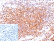 IHC staining of FFPE human tonsil tissue with recombinant CD40 antibody (clone C40/9225R). Inset: PBS used in place of primary Ab (secondary Ab negative control). HIER: boil tissue sections in pH 9 10mM Tris with 1mM EDTA for 20 min and allow to cool before testing.