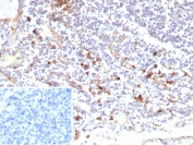 IHC staining of FFPE human tonsil tissue with recombinant IL3RA antibody (clone rIL3RA/9212). Inset: PBS used in place of primary Ab (secondary Ab negative control). HIER: boil tissue sections in pH 9 10mM Tris with 1mM EDTA for 20 min and allow to cool before testing.