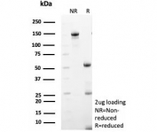 SDS-PAGE analysis of purified, BSA-free COL4A5 (COL4A5/9396R) as confirmation of integrity and purity.
