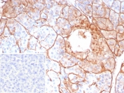 IHC staining of FFPE human pancreas tissue with COL4A5 antibody (clone COL4A5/9396R). Inset: PBS used in place of primary Ab (secondary Ab negative control). HIER: boil tissue sections in pH 9 10mM Tris with 1mM EDTA for 20 min and allow to cool before testing.