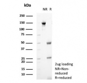 SDS-PAGE analysis of purified, BSA-free GnRH-Receptor antibody (clone A9E4) as confirmation of integrity and purity.