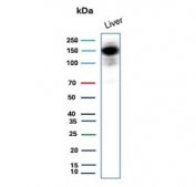 Western blot testing of human liver tissue lysate with recombinant Carbamoyl phosphate synthetase 1 antibody. Predicted molecular weight ~165 kDa.
