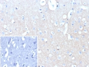 IHC staining of FFPE human brain tissue with recombinant NCAM-L1 antibody (clone L1CAM/9146R). Inset: PBS used in place of primary Ab (secondary Ab negative control). HIER: boil tissue sections in pH 9 10mM Tris with 1mM EDTA for 20 min and allow to cool before testing.