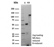 SDS-PAGE analysis of purified, BSA-free recombinant CD171 antibody (clone L1CAM/9267R) as confirmation of integrity and purity.