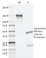 SDS-PAGE analysis of purified, BSA-free MRP1 antibody (clone MRP1/1343) as confirmation of integrity and purity.