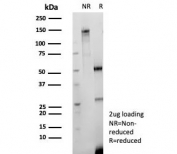 SDS-PAGE analysis of purified recombinant CD147 antibody (clone BSG/9290R) as confirmation of integrity and purity.