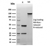 SDS-PAGE analysis of purified, BSA-free Cytokeratin 20 antibody (clone Ks20.8) as confirmation of integrity and purity.