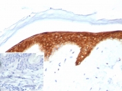 IHC staining of FFPE human skin tissue with SERPINB5 antibody (clone SERPINB5/4974). Inset: PBS used in place of primary Ab (secondary Ab negative control). HIER: boil tissue sections in pH 9 10mM Tris with 1mM EDTA for 20 min and allow to cool before testing.