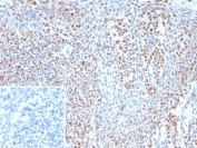 IHC staining of FFPE human tonsil tissue with recombinant Bcl-6 antibody (clone BCL6/9222R). Inset: PBS used in place of primary Ab (secondary Ab negative control). HIER: boil tissue sections in pH 9 10mM Tris with 1mM EDTA for 20 min and allow to cool before testing.