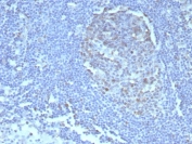 IHC staining of FFPE human tonsil tissue with Caspase 3 antibody (clone CASP3/8446). HIER: boil tissue sections in pH 9 10mM Tris with 1mM EDTA for 20 min and allow to cool before testing.