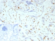 IHC staining of FFPE human placental tissue with p57Kip2 antibody (clone KIP2/7186). Inset: PBS used in place of primary Ab (secondary Ab negative control). HIER: boil tissue sections in pH 9 10mM Tris with 1mM EDTA for 20 min and allow to cool before testing.