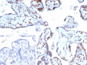 IHC staining of FFPE human placental tissue with p57 antibody (clone KIP2/7639). Strong nuclear staining observed using KIP2/7639 at 2ug/ml in PBS for 30min RT. Inset: PBS used in place of primary Ab (secondary Ab negative control). HIER: boil tissue sections in pH 9 10mM Tris with 1mM EDTA for 20 min and allow to cool before testing.