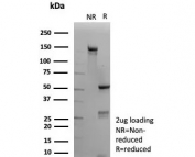 SDS-PAGE analysis of purified, BSA-free recombinant CNN1 antibody (clone rCNN1/9164) as confirmation of integrity and purity.