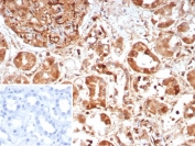 IHC staining of FFPE human kidney tissue with Caspase 7 antibody (clone CASP7/9051). Inset: PBS used in place of primary Ab (secondary Ab negative control). HIER: boil tissue sections in pH 9 10mM Tris with 1mM EDTA for 20 min and allow to cool before testing.