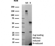 SDS-PAGE analysis of purified, BSA-free Caspase 7 antibody (clone CASP7/9051) as confirmation of integrity and purity.