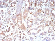 IHC staining of FFPE human kidney tissue with Caspase 7 antibody (clone CASP7/9052). HIER: boil tissue sections in pH 9 10mM Tris with 1mM EDTA for 20 min and allow to cool before testing.
