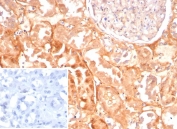 IHC staining of FFPE human kidney tissue with CASP7 antibody (clone CASP7/9053). Inset: PBS used in place of primary Ab (secondary Ab negative control). HIER: boil tissue sections in pH 9 10mM Tris with 1mM EDTA for 20 min and allow to cool before testing.