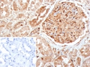 IHC staining of FFPE human kidney tissue with CASP7 antibody (clone CASP7/9054). Inset: PBS used in place of primary Ab (secondary Ab negative control). HIER: boil tissue sections in pH 9 10mM Tris with 1mM EDTA for 20 min and allow to cool before testing.