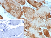 IHC staining of FFPE human skeletal muscle tissue with recombinant Alpha Actin 1 (ACTA1/9105R). Inset: PBS used in place of primary Ab (secondary Ab negative control). HIER: boil tissue sections in pH 9 10mM Tris with 1mM EDTA for 20 min and allow to cool before testing.