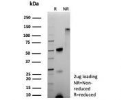 SDS-PAGE analysis of purified, BSA-free recombinant Hemoglobin alpha antibody (clone HBA/9193R) as confirmation of integrity and purity.