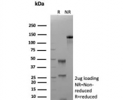 SDS-PAGE analysis of purified, BSA-free recombinant HBA antibody (clone rHBA/9167) as confirmation of integrity and purity.