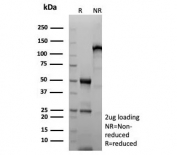 SDS-PAGE analysis of purified, BSA-free recombinant MDM2 antibody (clone rMDM2/9214) as confirmation of integrity and purity.