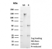 SDS-PAGE analysis of purified, BSA-free recombinant FLI1 antibody (clone rFLI1/9614) as confirmation of integrity and purity.