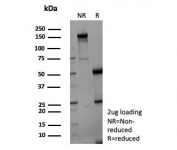 SDS-PAGE analysis of purified, BSA-free AKR1C1 antibody (clone AKR1C1/9069) as confirmation of integrity and purity.