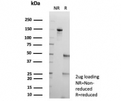 SDS-PAGE analysis of purified, BSA-free AKR1C1 antibody (clone AKR1C1/9311) as confirmation of integrity and purity.