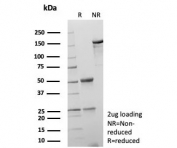 SDS-PAGE analysis of purified, BSA-free AKR1C1 antibody (clone AKR1C1/9314) as confirmation of integrity and purity.