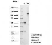 SDS-PAGE analysis of purified, BSA-free recombinant GAD2 antibody (clone rGAD2/9382) as confirmation of integrity and purity.