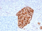 IHC staining of FFPE human pancreas tissue with recombinant GAD2 antibody (clone rGAD2/9382). Inset: PBS used in place of primary Ab (secondary Ab negative control). HIER: boil tissue sections in pH 9 10mM Tris with 1mM EDTA for 20 min and allow to cool before testing.