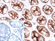 IHC staining of FFPE human colon tissue with recombinant CDH17 antibody (clone rCDH17/9677). Inset: PBS used in place of primary Ab (secondary Ab negative control). HIER: boil tissue sections in pH 9 10mM Tris with 1mM EDTA for 20 min and allow to cool before testing.