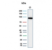 Western blot testing of human small intestine tissue lysate with recombinant CDH17 antibody. Predicted molecular weight ~92 kDa but may be observed at higher molecular weights due to glycosylation.
