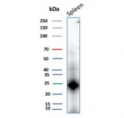 Western blot testing of human spleen tissue lysate with CD161 antibody. Predicted molecular weight ~25 kDa but may be observed at higher molecular weights due to glycosylation.